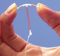 Birth Control The IUD 3
